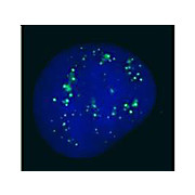 Anti-PC2 [RABBIT] Antibody, 100µg, Liquid (sterile filtered)