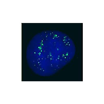 Anti-PC2 [RABBIT] Antibody, 100µg, Liquid (sterile filtered)
