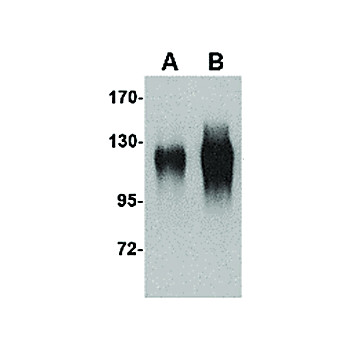 Anti-gp120 (GOAT) Antibody, 100µg, Liquid (sterile filtered)