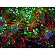Anti-Ubiquitin Hydrolase (UCHL1) (Chicken) Antibody, 100µL, Liquid