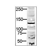 Anti-DIA-2 (RABBIT) Antibody, 100µg, Liquid (sterile filtered)
