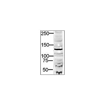 Anti-DIA-2 (RABBIT) Antibody, 100µg, Liquid (sterile filtered)