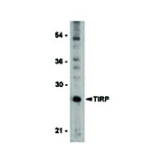 Anti-TIRP (RABBIT) Antibody, 100µg, Liquid (sterile filtered)