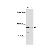 Anti-MTBP (Ascites) (MOUSE) Monoclonal Antibody, 100µL, Liquid (sterile filtered)
