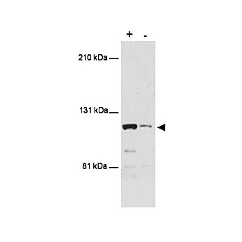 Anti-MTBP (Ascites) (MOUSE) Monoclonal Antibody, 100µL, Liquid (sterile filtered)
