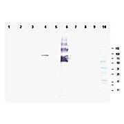 Anti-Ankrd26 (RABBIT) Antibody, 100µg, Liquid (sterile filtered)