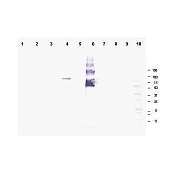 Anti-Ankrd26 (RABBIT) Antibody, 100µg, Liquid (sterile filtered)