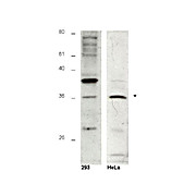 Anti-HUS1B (RABBIT) Antibody, 100µg, Liquid (sterile filtered)