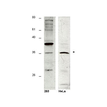 Anti-HUS1B (RABBIT) Antibody, 100µg, Liquid (sterile filtered)