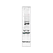 Anti-Tlk1 (RABBIT) Antibody, 100µg, Liquid (sterile filtered)