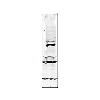 Anti-Tlk1 (RABBIT) Antibody, 100µg, Liquid (sterile filtered)