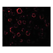 Anti-MADD (RABBIT) Antibody, 100µg, Liquid (sterile filtered)