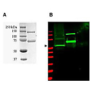 Anti-SUMO Activating Enzyme E1 (RABBIT) Antibody, 500µg, Lyophilized