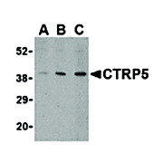 CTRP5 Antibody internal 100µg