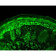 Anti-Cpn10 (RABBIT) Antibody, 100µg, Liquid (sterile filtered)