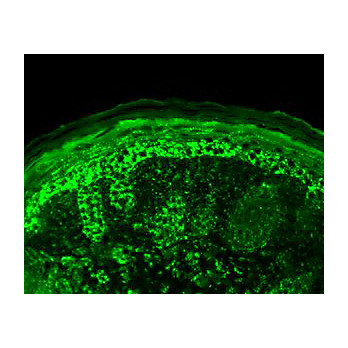 Anti-Cpn10 (RABBIT) Antibody, 100µg, Liquid (sterile filtered)