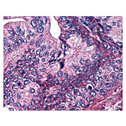 Anti-APC1 pS377 (RABBIT) Antibody, 100µg, Liquid (sterile filtered)