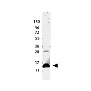 Anti-Human IL-9 (RABBIT) Antibody, 100µg, Lyophilized