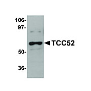 Anti-TCC52 (CHICKEN) Antibody, 100µg, Liquid (sterile filtered)