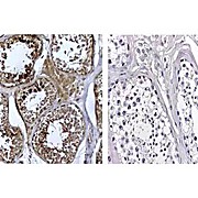 Anti-Human DNMT3L (RABBIT) Antibody, 100µg, Liquid (sterile filtered)