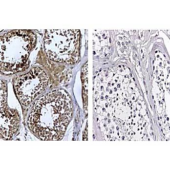 Anti-Human DNMT3L (RABBIT) Antibody, 100µg, Liquid (sterile filtered)