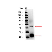Anti-ACID PHOSPHATASE (Potato) (RABBIT) Antibody Peroxidase Conjugated, 100µg, Lyophilized
