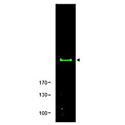 Anti-mTOR (RABBIT) Antibody, 100µg, Liquid (sterile filtered)