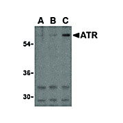 ATR cterm Antibody 100µg