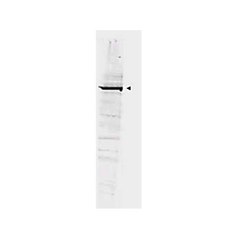 Anti-GGA1 (RABBIT) Antibody, 100µg, Liquid (sterile filtered)