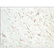 Anti-SFRP1 (RABBIT) Antibody, 25µL, Liquid (sterile filtered)