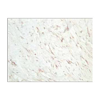 Anti-SFRP1 (RABBIT) Antibody, 25µL, Liquid (sterile filtered)
