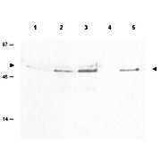 Anti-Cyclin B1 pS126 (RABBIT) Antibody, 100µg, Liquid (sterile filtered)