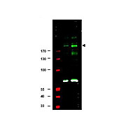 Anti-IRS1 pS307 (RABBIT) Antibody, 100µg, Liquid (sterile filtered)