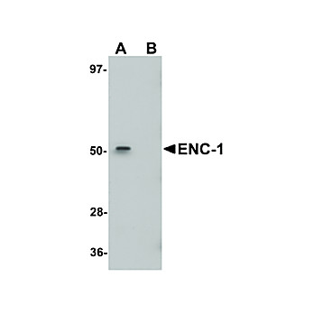 Anti-ENC-1 (CHICKEN) Antibody, 100µg, Liquid (sterile filtered)