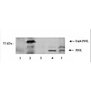 Anti-PNK (Polynucleotide Kinase) (RABBIT) Antibody, 100µg, Liquid (sterile filtered)