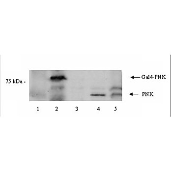 Anti-PNK (Polynucleotide Kinase) (RABBIT) Antibody, 100µg, Liquid (sterile filtered)