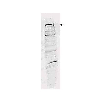 Anti-Human ESET (RABBIT) Antibody, 100µg, Liquid (sterile filtered)