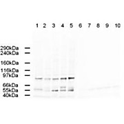 Anti-AP2A (GOAT) Antibody, 100µg, Liquid (sterile filtered)
