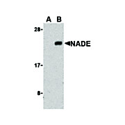 Anti-NADE (RABBIT) Antibody, 100µg, Liquid (sterile filtered)