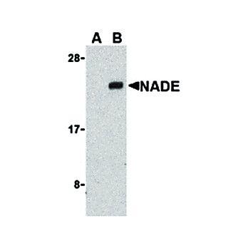 Anti-NADE (RABBIT) Antibody, 100µg, Liquid (sterile filtered)