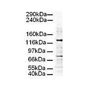 Anti-AP3D1 (GOAT) Antibody, 100µg, Liquid (sterile filtered)