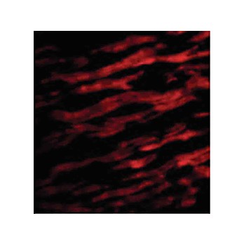 Anti-TIRAP (RABBIT) Antibody, 100µg, Liquid (sterile filtered)