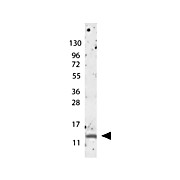 Anti-Human MIP-1ß (RABBIT) Antibody, 100µg, Lyophilized
