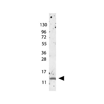 Anti-Human MIP-1ß (RABBIT) Antibody, 100µg, Lyophilized