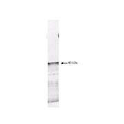 Anti-PDK1 (RABBIT) Antibody, 100µg, Liquid (sterile filtered)