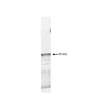Anti-PDK1 (RABBIT) Antibody, 100µg, Liquid (sterile filtered)