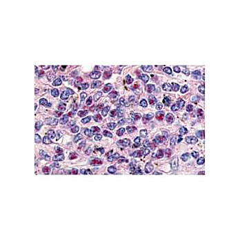 Anti-Cyclin L1 (isoform 1) [RABBIT] Antibody, 500µg, Lyophilized