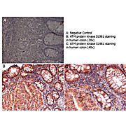 Anti-ATM Protein Kinase S1981 (RABBIT) Antibody, 100µg, Liquid (sterile filtered)