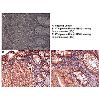 Anti-ATM Protein Kinase S1981 (RABBIT) Antibody, 100µg, Liquid (sterile filtered)