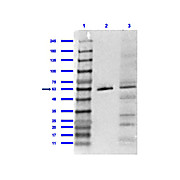 Anti-PPAR gamma 1 and 2 (internal) (RABBIT) Antibody, 100µg, Liquid (sterile filtered)